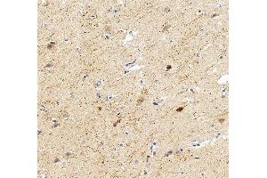 IHC analysis of Calretinin/CALB2 using anti-Calretinin/CALB2 antibody (ABIN7602106).