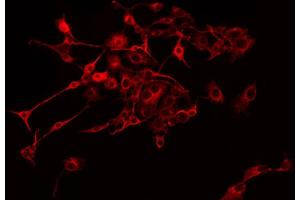 Immunofluorescence (fixed cells) (IF/ICC) image for anti-NADH Dehydrogenase (Ubiquinone) 1 beta Subcomplex, 9, 22kDa (NDUFB9) (Internal Region) antibody (ABIN6259299)
