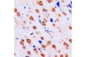 Immunohistochemical analysis of CHK1 (pS317) staining in human brain formalin fixed paraffin embedded tissue section. (CHEK1 Antikörper  (pSer317))