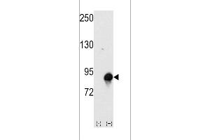 Western blot analysis of CUL4a using rabbit polyclonal CUL4a Antibody (Human N-term). (Cullin 4A Antikörper  (N-Term))