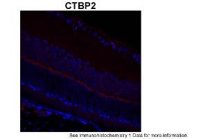 Sample Type: complete mouse retina sectionsRed: PrimaryBlue: DAPIPrimary Dilution: 1:200Secondary Antibody: Goat anti-Rabbit AF568 IgG(H+L)Secondary Dilution: 1:200Image Submitted by: David ZenisekYale University (CTBP2 Antikörper  (C-Term))