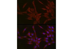 Immunofluorescence (IF) image for anti-Nephronophthisis 1 (Juvenile) (NPHP1) (AA 345-614) antibody (ABIN6144768)