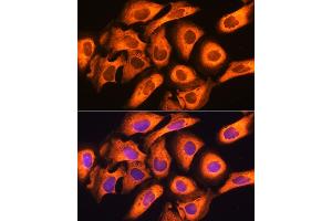Immunofluorescence analysis of U20S cells using Rig-I/DDX58 antibody (ABIN6130263, ABIN6139513, ABIN6139515 and ABIN6217394) at dilution of 1:100. (DDX58 Antikörper  (AA 726-925))