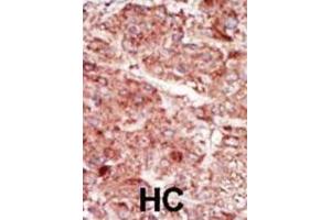 Immunohistochemistry (IHC) image for anti-Hexokinase 3 (White Cell) (HK3) antibody (ABIN3003707) (HK3 Antikörper)