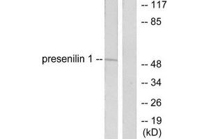 Western Blotting (WB) image for anti-Presenilin 1 (PSEN1) (N-Term) antibody (ABIN1848748) (Presenilin 1 Antikörper  (N-Term))
