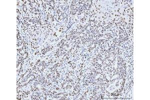 IHC analysis of MCM6 using anti-MCM6 antibody (ABIN7600037). (MCM6 Antikörper  (AA 14-821))