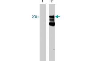 Western blot analysis of A-431 cells serum starved overnight (lane 1) and treated with pervanadate (1mM) for 30 min (lane 2). (Integrin beta 4 Antikörper  (pTyr1494))