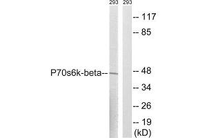 Western Blotting (WB) image for anti-Ribosomal Protein S6 Kinase, 70kDa, Polypeptide 2 (RPS6KB2) (Ser423) antibody (ABIN1848244) (RPS6KB2 Antikörper  (Ser423))