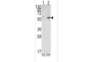 Western blot analysis of PTEN (arrow) using rabbit PTEN Antibody (N-term) (ABIN6242545 and ABIN6579042). (PTEN Antikörper  (N-Term))