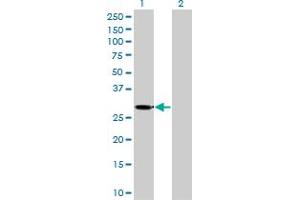Western Blotting (WB) image for anti-Ketohexokinase (KHK) (AA 1-299) antibody (ABIN598769) (Ketohexokinase Antikörper  (AA 1-299))