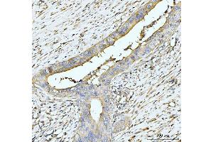 IHC analysis of HUPF2/RENT2/UPF2 using anti-HUPF2/RENT2/UPF2 antibody (ABIN7600567). (RENT2/UPF2 Antikörper  (AA 200-651))