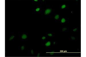 Immunofluorescence of monoclonal antibody to MAZ on HeLa cell.
