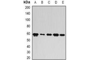 Western blot analysis of FIR expression in A549 (A), mouse brain (B), mouse spleen (C), rat lung (D), rat liver (E) whole cell lysates. (FARP2 Antikörper)