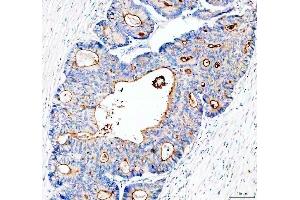 IHC analysis of MUC13 using anti-MUC13 antibody (ABIN6719597).