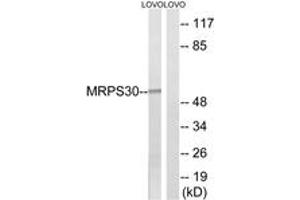 Western blot analysis of extracts from LOVO cells, using MRPS30 Antibody. (MRPS30 Antikörper  (AA 390-439))