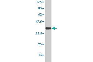 Western Blot detection against Immunogen (36. (UBE2D2 Antikörper  (AA 1-94))