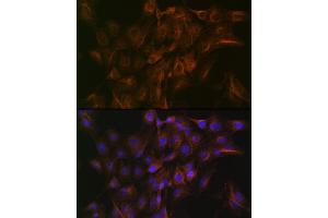 Immunofluorescence analysis of C6 cells using Arp3 Rabbit mAb (ABIN7265676) at dilution of 1:100 (40x lens). (ACTR3 Antikörper)