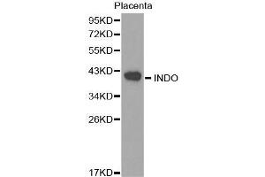 Western blot analysis of extracts of Placenta cell lines, using INDO antibody. (IDO1 Antikörper  (AA 204-403))
