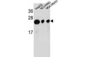 Western Blotting (WB) image for anti-ATP Synthase, H+ Transporting, Mitochondrial Fo Complex, Subunit D (ATP5H) antibody (ABIN2995555)