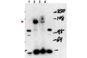 Image no. 1 for anti-Nuclear Receptor Coactivator 3 (NCOA3) (Internal Region), (Isoform A) antibody (ABIN401408) (NCOA3 Antikörper  (Internal Region, Isoform A))