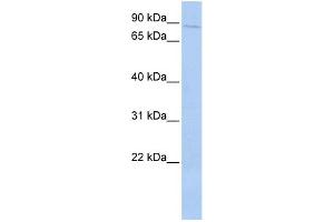 WB Suggested Anti-PRKRIR Antibody Titration: 0. (PRKRIR Antikörper  (N-Term))