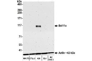 Western Blotting (WB) image for anti-B-Cell CLL/lymphoma 11A (Zinc Finger Protein) (BCL11A) (AA 785-835) antibody (ABIN7452847)