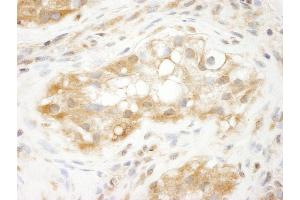 Immunohistochemistry (IHC) image for anti-Tripartite Motif Containing 3 (TRIM3) (AA 1-50) antibody (ABIN7448842) (TRIM3 Antikörper  (AA 1-50))