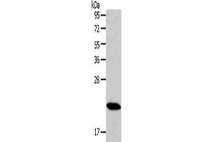 Western Blotting (WB) image for anti-RAB18, Member RAS Oncogene Family (RAB18) antibody (ABIN2430977) (RAB18 Antikörper)