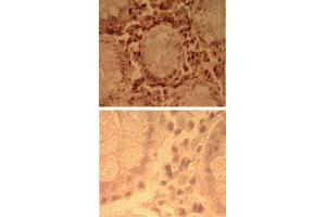 Immunohistochemical analysis of human colon tissue using TLR7 polyclonal antibody  (top) and an isotype control (bottom) at 5 ug/mL .