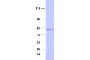 Western Blotting (WB) image for Docking Protein 6 (DOK6) protein (His tag) (ABIN2719654)