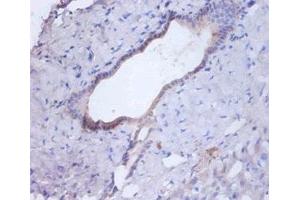 Immunohistochemistry of paraffin-embedded human liver tissue using ABIN7146996 at dilution of 1:100 (Cathepsin B Antikörper  (AA 82-333))