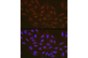 Immunofluorescence analysis of U2OS cells using  Rabbit pAb (ABIN6131258, ABIN6137246, ABIN6137247 and ABIN6223428) at dilution of 1:100 (40x lens). (ATG14 Antikörper  (AA 1-310))