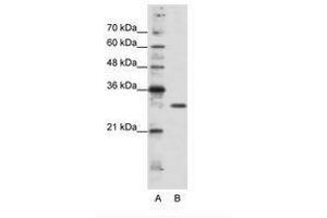 Image no. 2 for anti-Goosecoid Homeobox 2 (GSC2) (C-Term) antibody (ABIN202063) (GSC2 Antikörper  (C-Term))