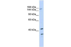 WB Suggested Anti-ABCC8 Antibody Titration:  0. (ABCC8 Antikörper  (N-Term))
