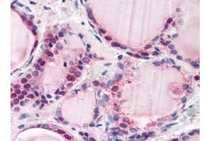 Image no. 1 for anti-F-Box and Leucine-Rich Repeat Protein 3 (FBXL3) (N-Term) antibody (ABIN372963) (FBXL3 Antikörper  (N-Term))