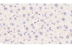 Detection of APOF in Mouse Liver Tissue using Polyclonal Antibody to Apolipoprotein F (APOF) (Apolipoprotein F Antikörper  (AA 111-314))