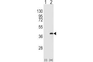 Western Blotting (WB) image for anti-Protein Phosphatase 1, Catalytic Subunit, beta Isoform (PPP1CB) antibody (ABIN3003759) (PPP1CB Antikörper)