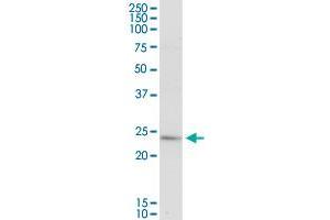 PLA2G16 MaxPab rabbit polyclonal antibody. (PLA2G16 Antikörper  (AA 1-162))