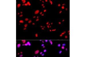Immunofluorescence analysis of GFP-RNF168 transgenic U2OS cells using RPA2 Polyclonal Antibody (RPA2 Antikörper)