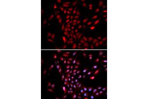 Immunofluorescence analysis of U2OS cells using KPNA4 antibody. (KPNA4 Antikörper)