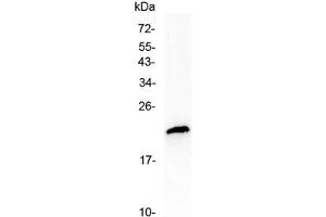 Western blot testing of human MCF7 cell lysate with TMEM107 antibody at 0. (TMEM107 Antikörper  (AA 22-57))