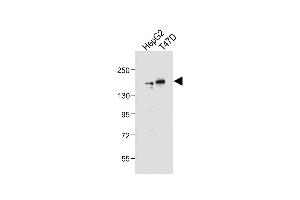 All lanes : Anti-HDAC6 Antibody (C-term) at 1:2000 dilution Lane 1: HepG2 whole cell lysate Lane 2: T47D whole cell lysate Lysates/proteins at 20 μg per lane. (HDAC6 Antikörper  (C-Term))