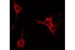 ABIN6274980 staining Hela cells by IF/ICC. (CDC42EP3 Antikörper  (Internal Region))