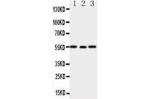 Western Blotting (WB) image for anti-X-Linked Inhibitor of Apoptosis (XIAP) (AA 14-34), (N-Term) antibody (ABIN3044425) (XIAP Antikörper  (N-Term))