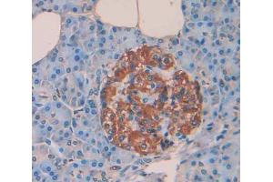 Used in DAB staining on fromalin fixed paraffin- embedded Kidney tissue (PTPRN Antikörper  (AA 35-185))