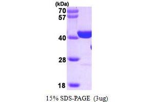 SDS-PAGE (SDS) image for Poly (ADP-Ribose) Polymerase 1 (PARP1) (AA 662-1014) protein (ABIN666940)