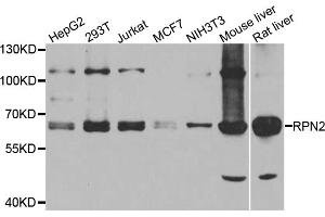 Western blot analysis of extracts of various cell lines, using RPN2 antibody (ABIN5974836) at 1/1000 dilution. (Ribophorin II Antikörper)