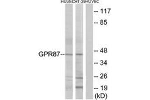 Western blot analysis of extracts from HuvEc/HT-29 cells, using GPR87 Antibody.