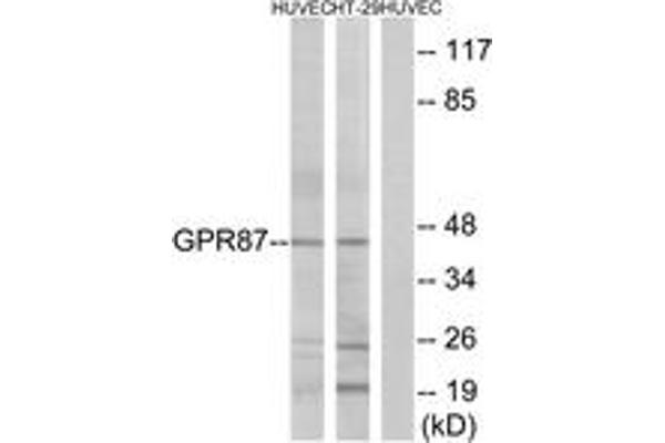 GPR87 anticorps  (AA 221-270)