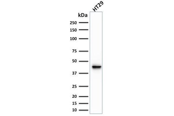 KRT20 Antikörper  (AA 196-323)